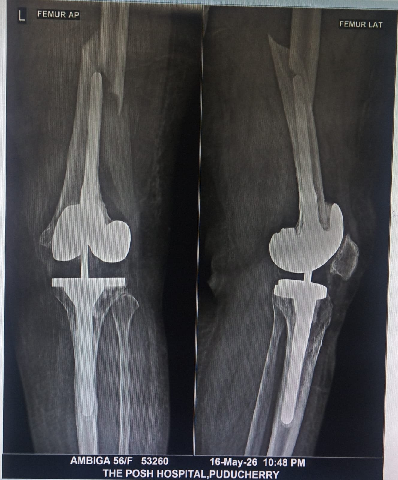 Knee assessment